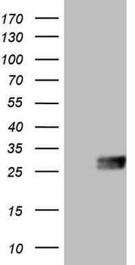 CSF2 / GM-CSF Antibody (aa18-144, clone OTI1A3, Carrier-free)