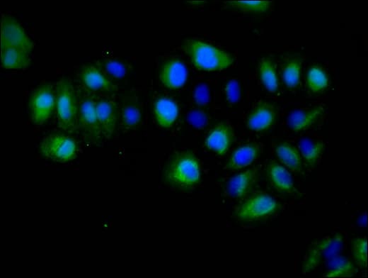 EPHA5 / EPH Receptor A5 Antibody
