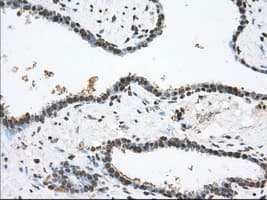 ERIC-1 / TACC3 Antibody (clone OTI6C6)