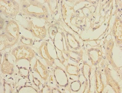 TTC33 Antibody