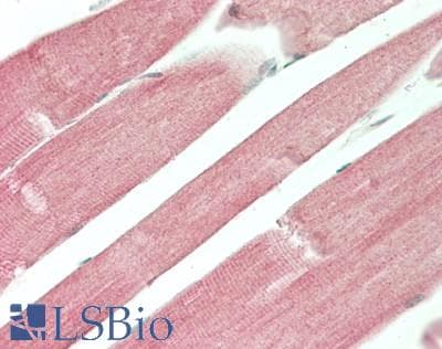 IHC-plus™ CAV3 / Caveolin 3 Antibody (aa1-151)