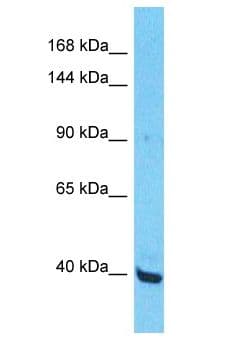 Polyclonal Rabbit anti-Human ZNF552 Antibody (aa181-230, WB)