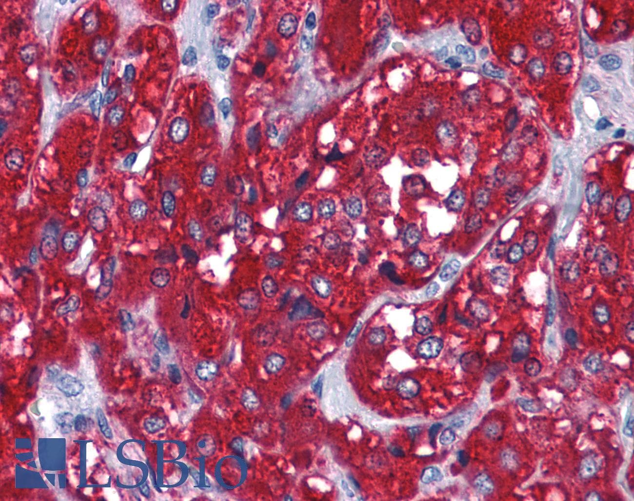 PathPlus™ SYP / Synaptophysin Antibody (clone 7H12)