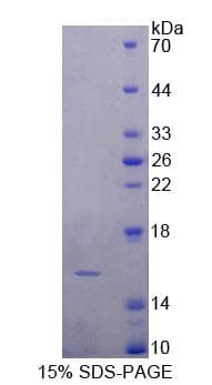 Human FABP4 / AP2 Protein (Recombinant His, N-Terminal)