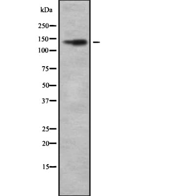 Polyclonal Rabbit anti-Human CDH4 / R Cadherin Antibody (WB)