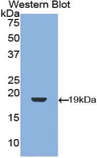 TGFB1 / TGF Beta 1 Antibody (aa279-390, APC)