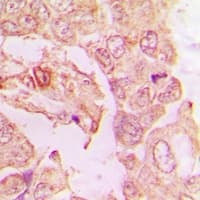 RHOT1 Antibody