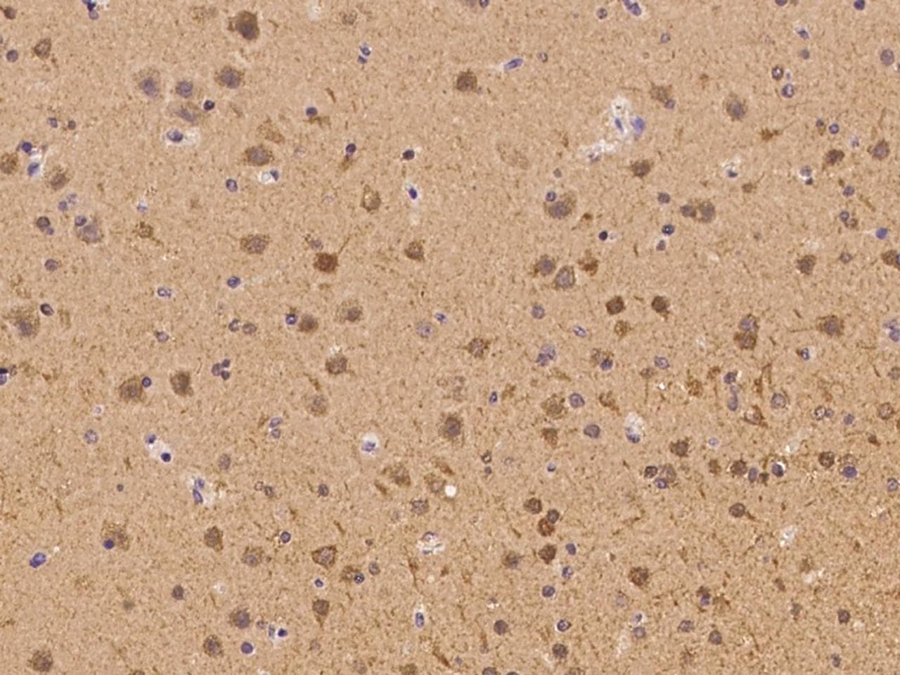 CHML Antibody