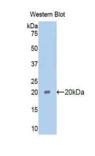 PIM1 / Pim-1 Antibody (aa38-177, HRP)