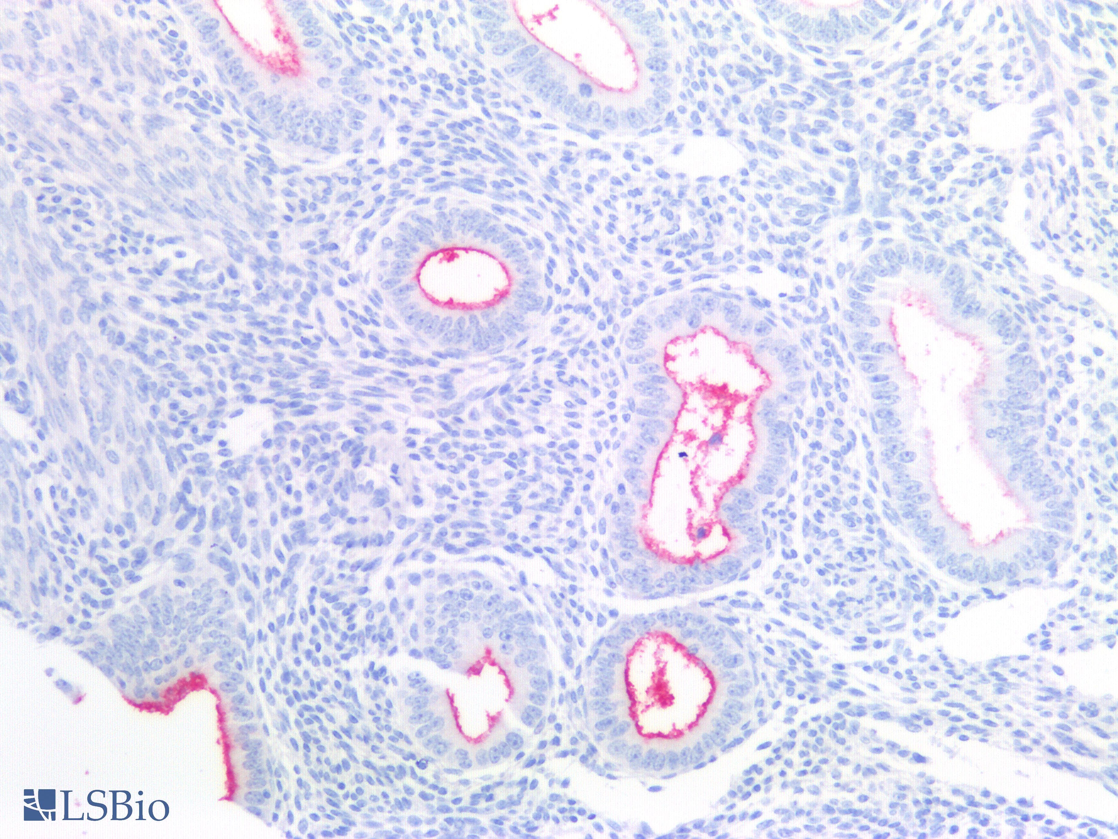 PathPlus™ EMA / MUC1 Antibody (Internal)