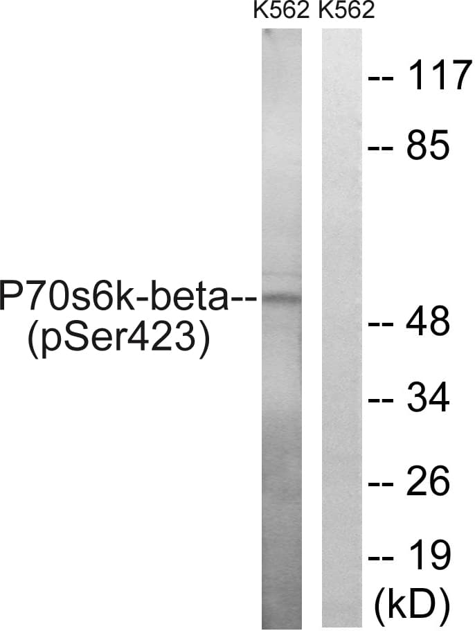 RPS6KB2 / S6K2 Antibody (phospho-Ser423)