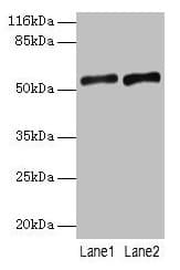Polyclonal Rabbit anti-Human SLC2A4 / GLUT-4 Antibody (aa223-287, IHC, WB)