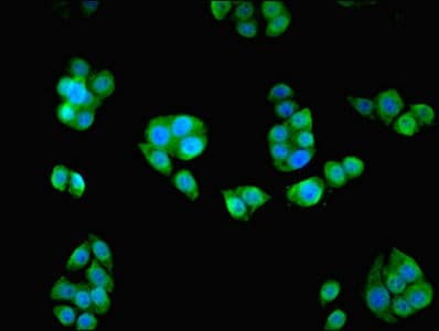 HAUS8 Antibody