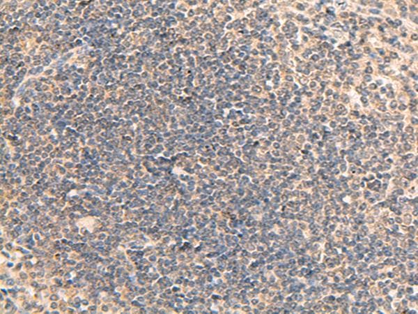RPL13A Antibody