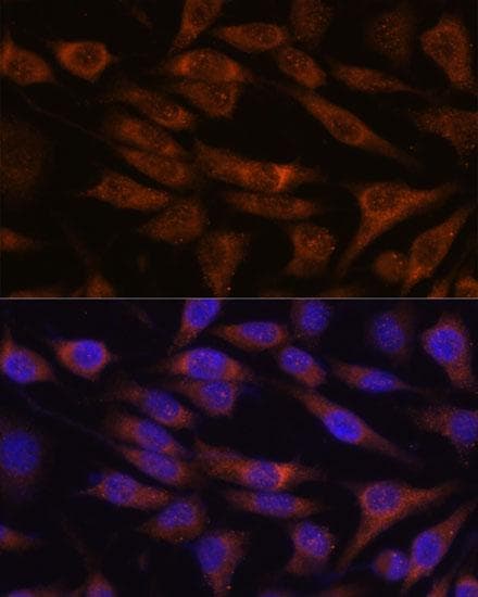 Polyclonal Rabbit anti-Human UNC13B Antibody (IF, WB)