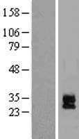 DAND5 Protein (Over-Expression Lysate Myc-DDK (Flag))