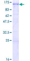 Human CEP85 / CCDC21 Protein (Recombinant GST)