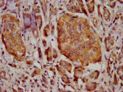 MT3 / Metallothionein 3 Antibody