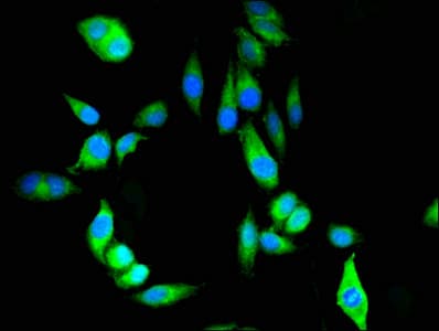 PRDX6 / Peroxiredoxin 6 Antibody