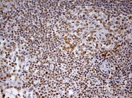 DDX56 Antibody (aa323-547, clone OTI2E5)