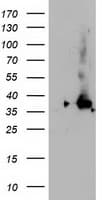 NUDT18 Antibody (clone OTI5D7)