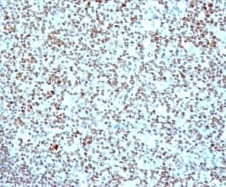 NCL / Nucleolin Antibody (clone SPM614)