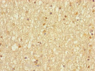 DHRS13 Antibody
