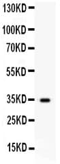 HGF / Hepatocyte Growth Factor Antibody (aa33-64)