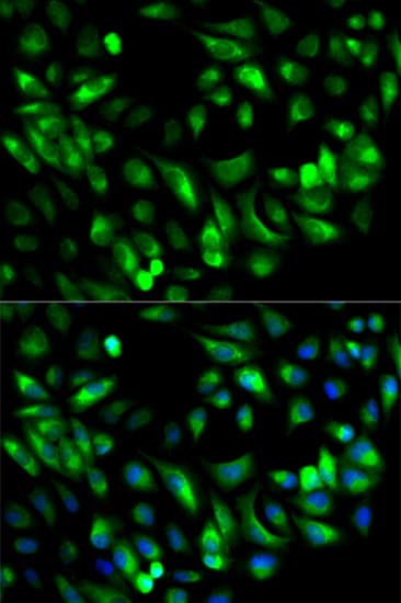 IHC-plus™ Polyclonal Rabbit anti-Human GARS / Glycyl tRNA Synthetase Antibody (IHC, IF, WB)