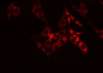 IGSF4C / CADM4 Antibody