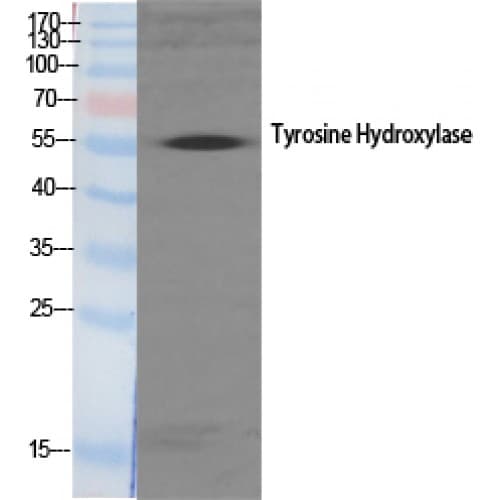 Polyclonal Rabbit anti-Human TH / Tyrosine Hydroxylase Antibody (10-90 aa, IHC, IF, WB)