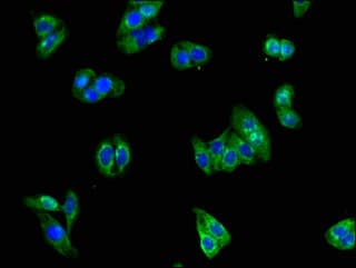 GRIN1 / NMDAR1 Antibody
