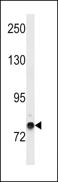 Polyclonal Rabbit anti-Human ZNF12 Antibody (aa102-128, WB)