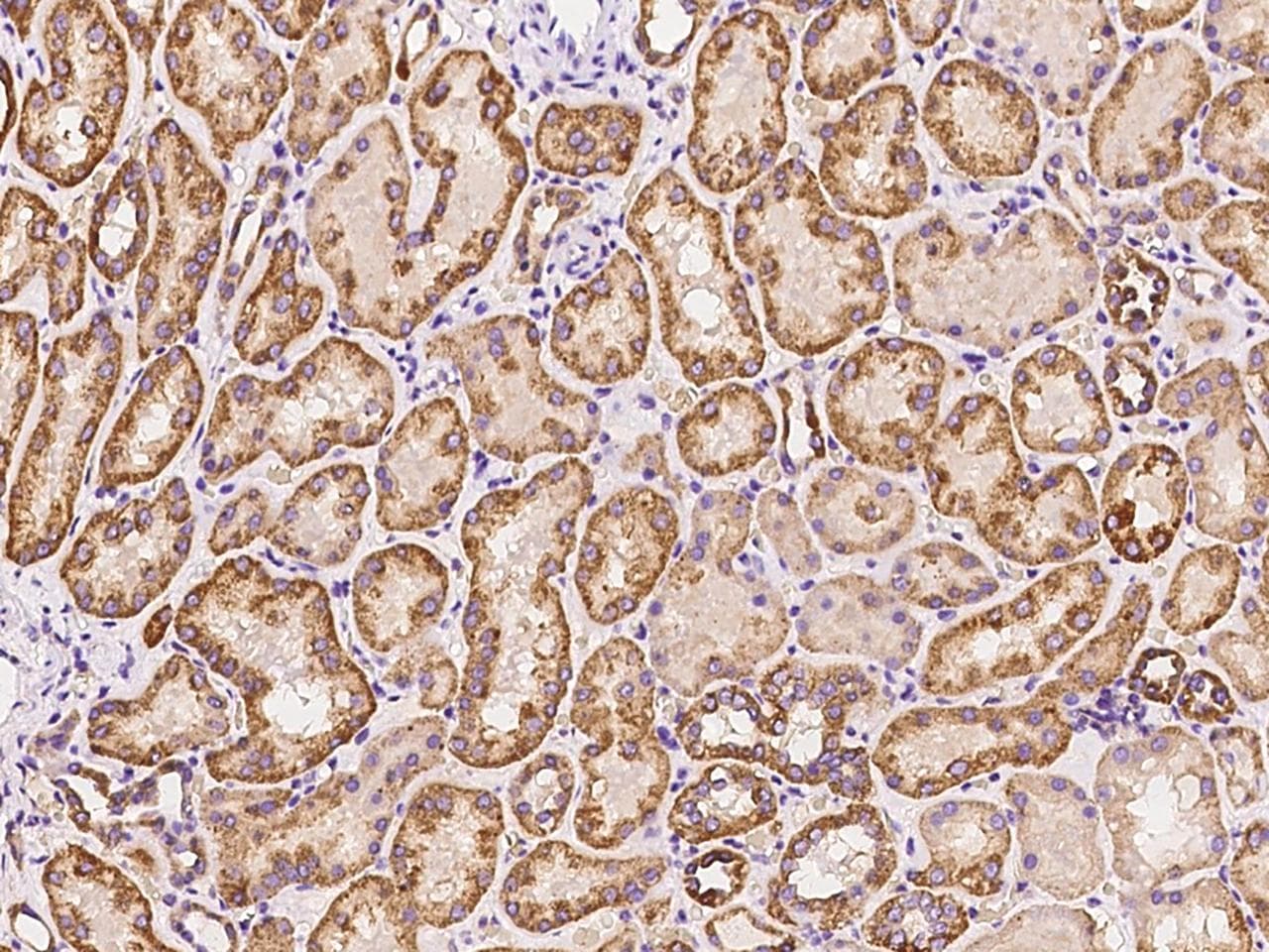 Polyclonal Rabbit anti-Human ERI2 / EXOD1 Antibody (IHC)