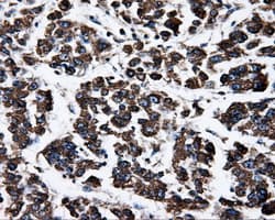 ATP5B / ATP Synthase Beta Antibody (clone OTI1B10)