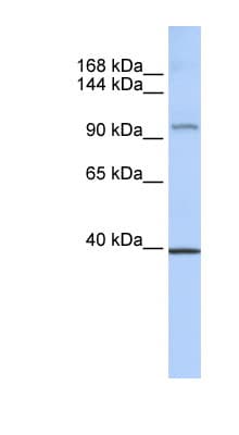 NRSF / REST Antibody (aa972-1021)