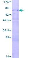 Human CPN1 Protein (Recombinant GST)