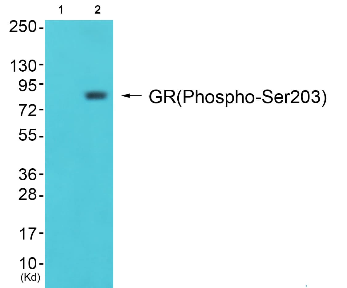 NR3C1/Glucocorticoid Receptor Antibody (phospho-Ser203)