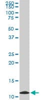 TIMM9 Antibody (clone 1D6)