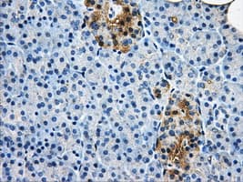 Monoclonal Mouse anti-Human AKR1A1 Antibody (clone OTI8H2, IHC, WB)