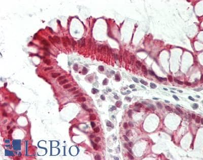 IHC-plus™ Polyclonal Rabbit anti-Human NAMPT / Visfatin Antibody (aa413-431, IHC, WB)