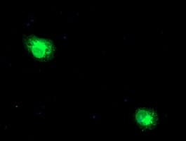 RPN1 / Ribophorin I Antibody (clone OTI5A1)