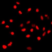 Polyclonal Rabbit anti-Human SPY1 / SPDYA Antibody (IF, WB)