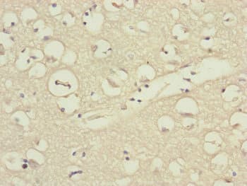 DSN1 Antibody