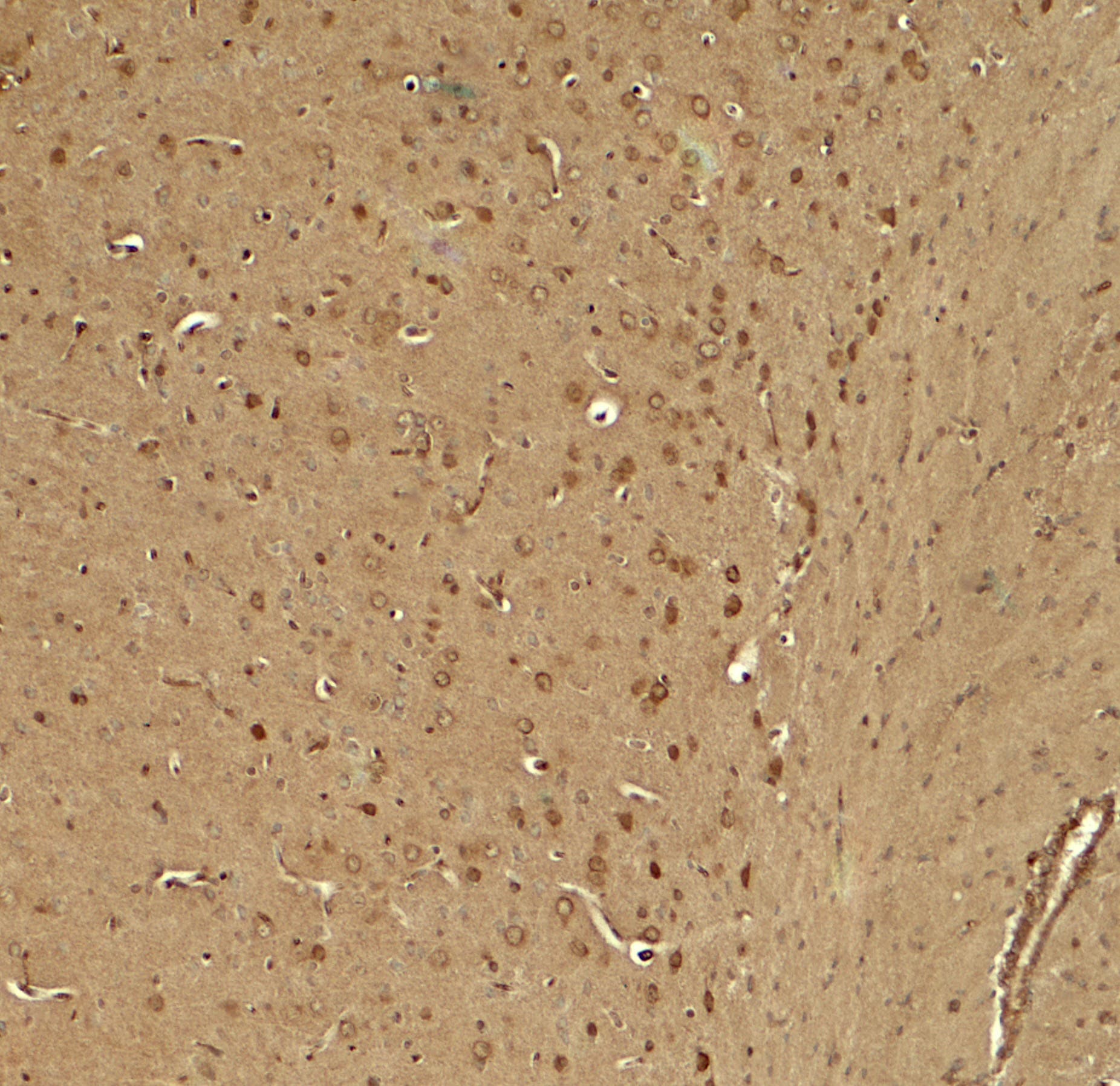 IHC-plus™ Polyclonal Rabbit anti-Human TWIK1 / KCNK1 Antibody (IHC, IF, WB)
