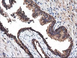 HARS2 Antibody (clone OTI3F1)
