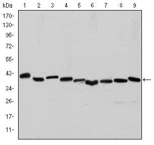 ACTA2 / Smooth Muscle Actin Antibody (clone 4A4)