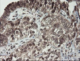 P3H1 / LEPRE1 Antibody (clone OTI1H3)