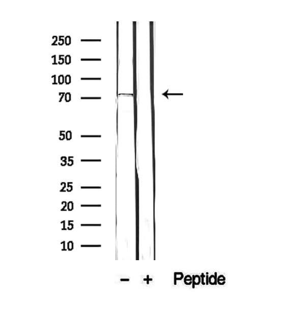 Polyclonal Rabbit anti-Human FXR1 Antibody (IHC, IF, WB)