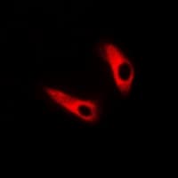 Polyclonal Rabbit anti-Human GPRC5C Antibody (IF, WB)